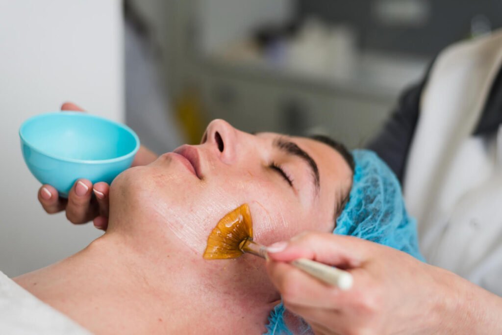 Chemical Peels In Lucknow