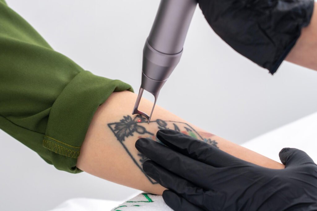 Tattoo Removal Course In Lucknow